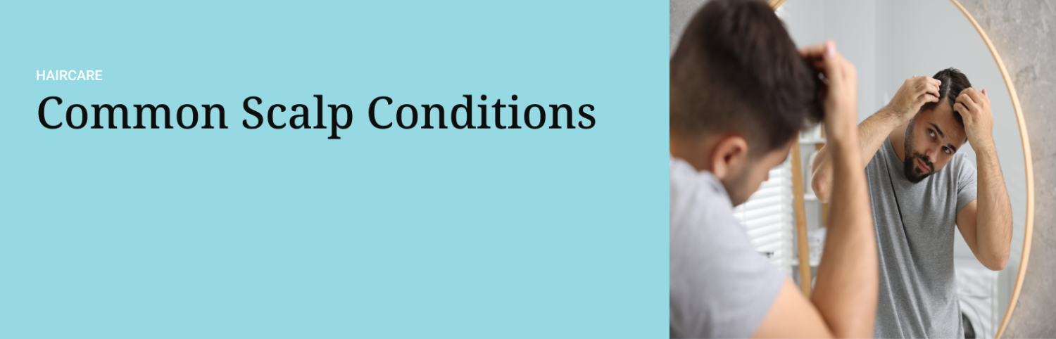 Common Scalp Conditions