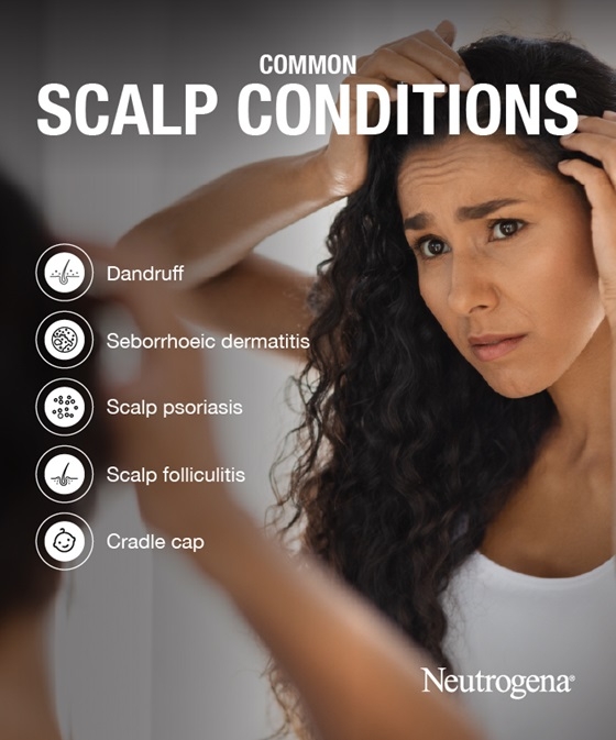 Scalp Conditions